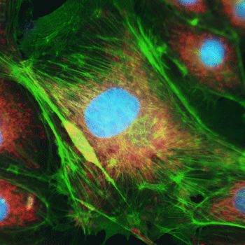 細胞の蛍光観察像のイメージ